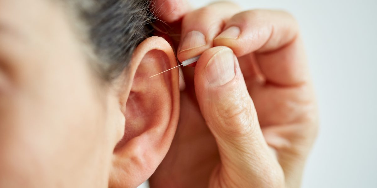 Nahaufnahme einer Hand, die eine Nadel in das Ohr einer Person für Akupunktur einführt.