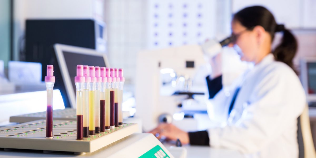Reagenzgläser mit Flüssigkeiten im Vordergrund, Wissenschaftlerin schaut durch ein Mikroskop im Labor im Hintergrund.