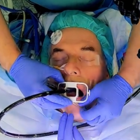 Person während einer medizinischen Untersuchung mit einem Endoskop im Mund; trägt OP-Mütze; blaue Handschuhe im Einsatz.