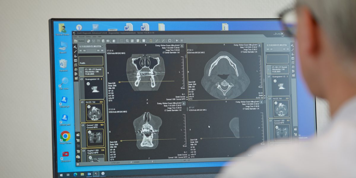 Person betrachtet CT-Scans auf einem Computerbildschirm mit medizinischer Bildbearbeitungssoftware.